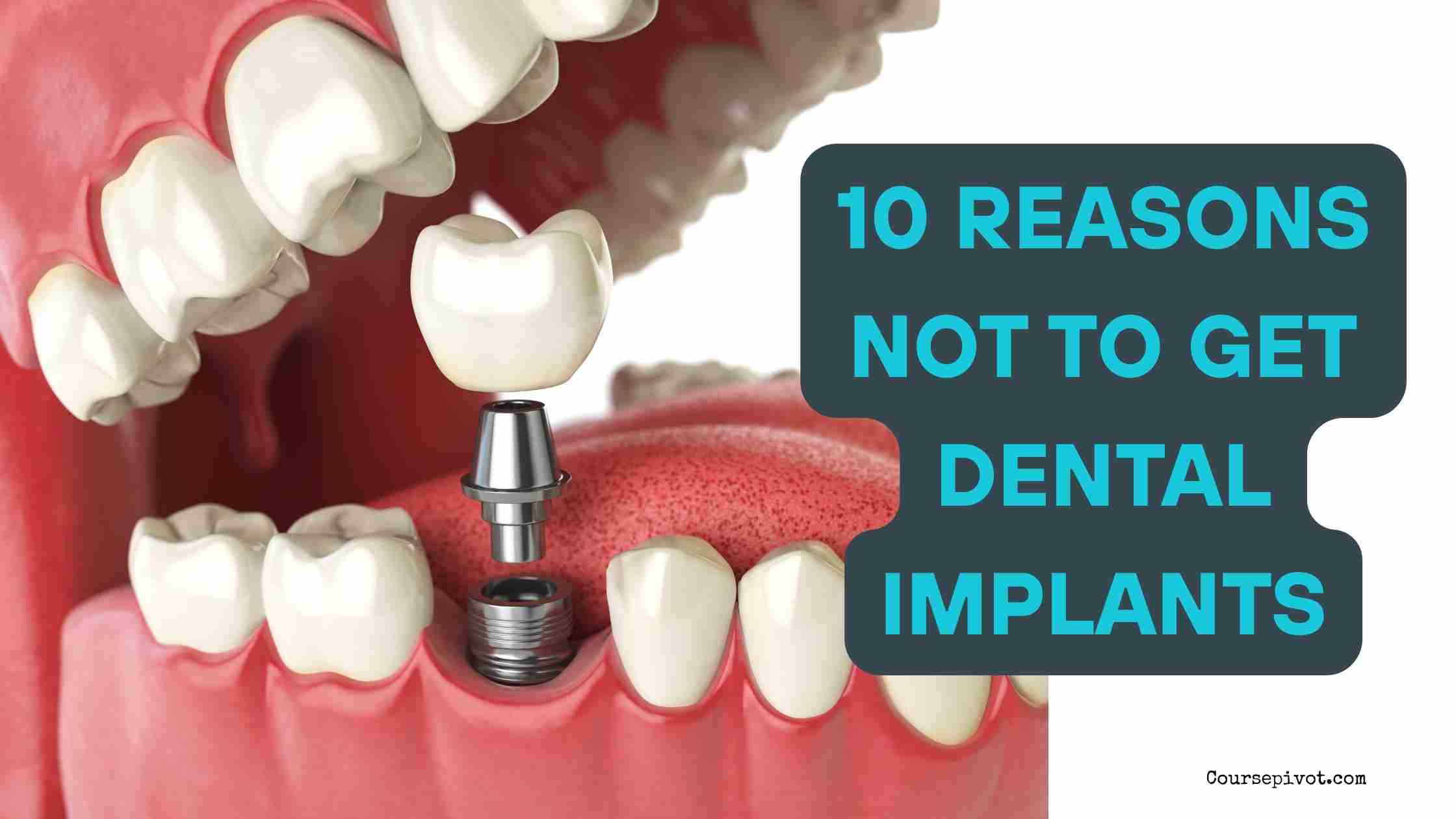 10 Reasons Not to Get Dental Implants